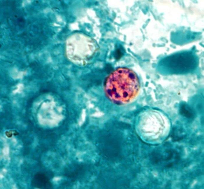 Trump admin shelves Cyclospora...
