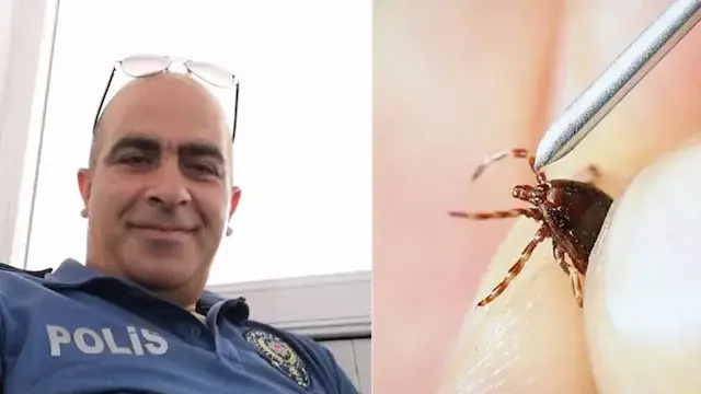 لدغة قرادة تُنهي حياة رجل بعد...