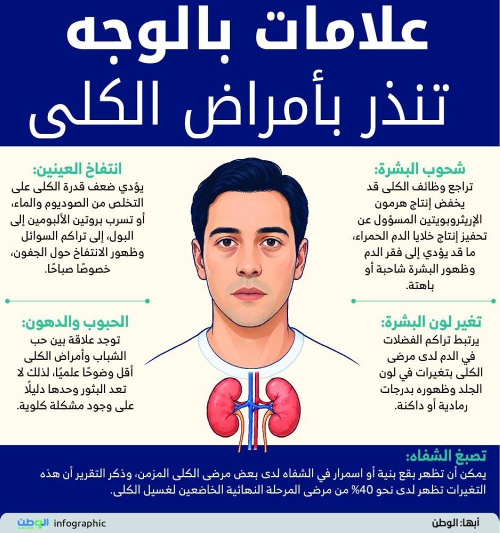 علامات بالوجه تنذر بأمراض الكل...