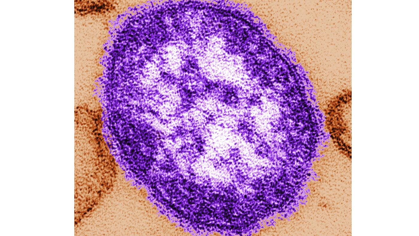 Pennsylvania says an unvaccina...