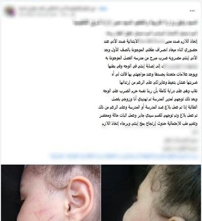 الداخلية تكشف تفاصيل تعدي معلمة على طالبة وإصابتها داخل مدرسة بالإسكندرية