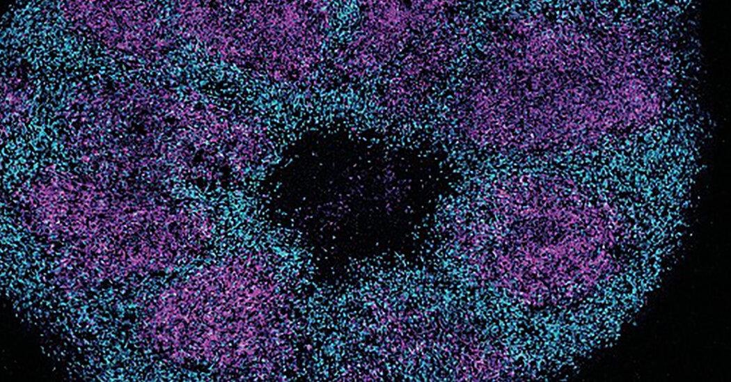 A Study of Brain Proteins Offe...