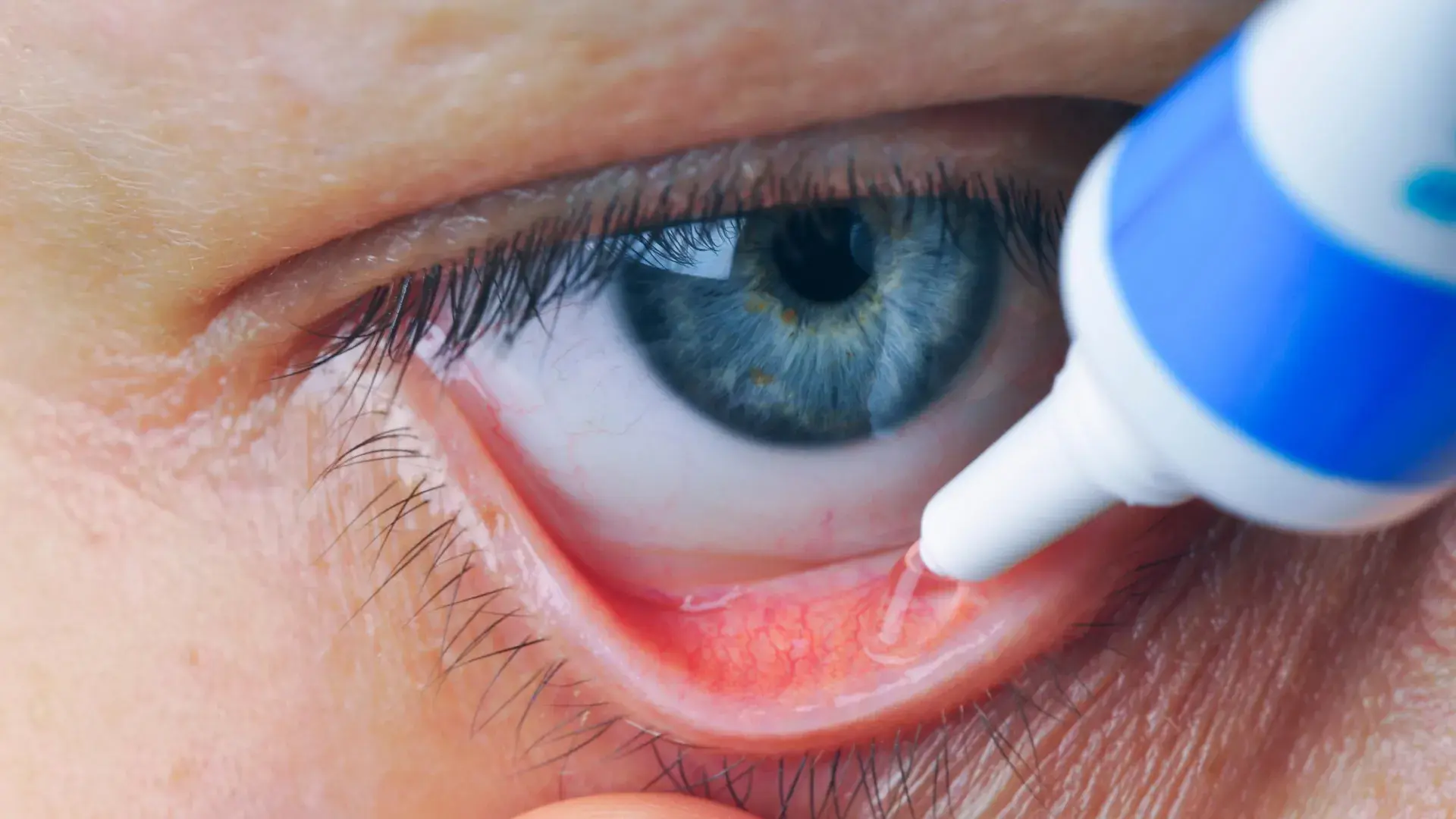 Experimental eye drops help bl...