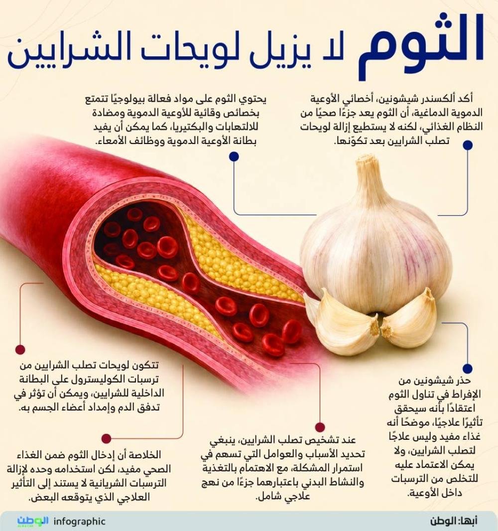 الثوم لا يزيل لويحات الشرايين