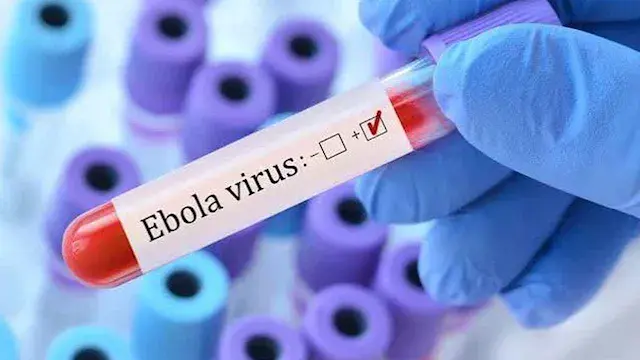 فيروس إيبولا يثير القلق في كينيا.. إصابات جديدة بين العاملين بالقطاع الصحي