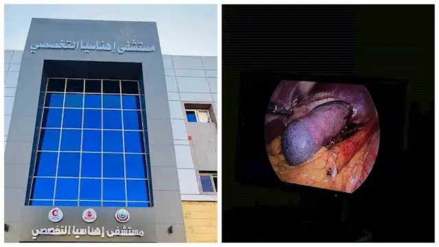 لأول مرة.. مستشفى إهناسيا التخ...