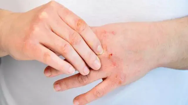 حتى مع النظافة اليومية.. لماذا...