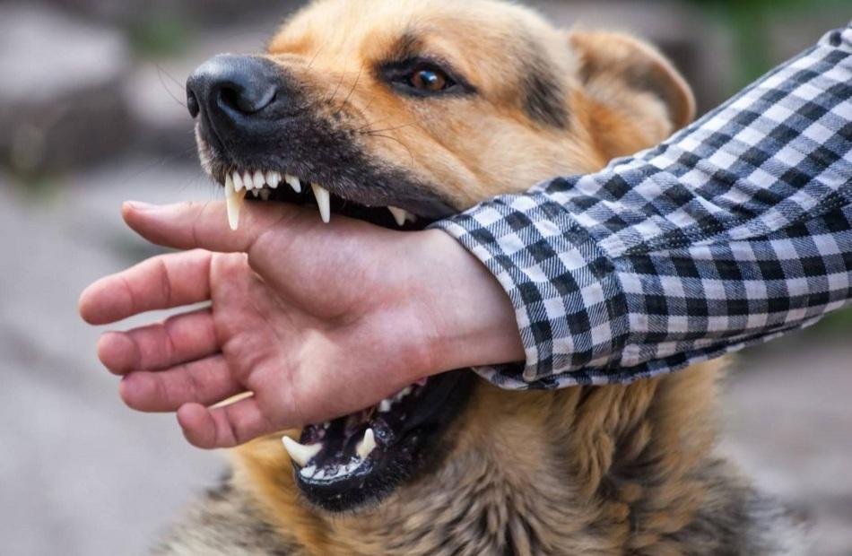 بعد وفاة الطفلة مكة.. المصل واللقاح: لا تستهينوا بعضة أو خدش الكلاب والقطط