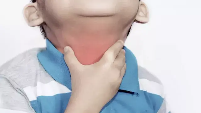 ما هو الاختناق الحنجري؟.. أستاذ أمراض الصدر يوضح علامات الإصابة
