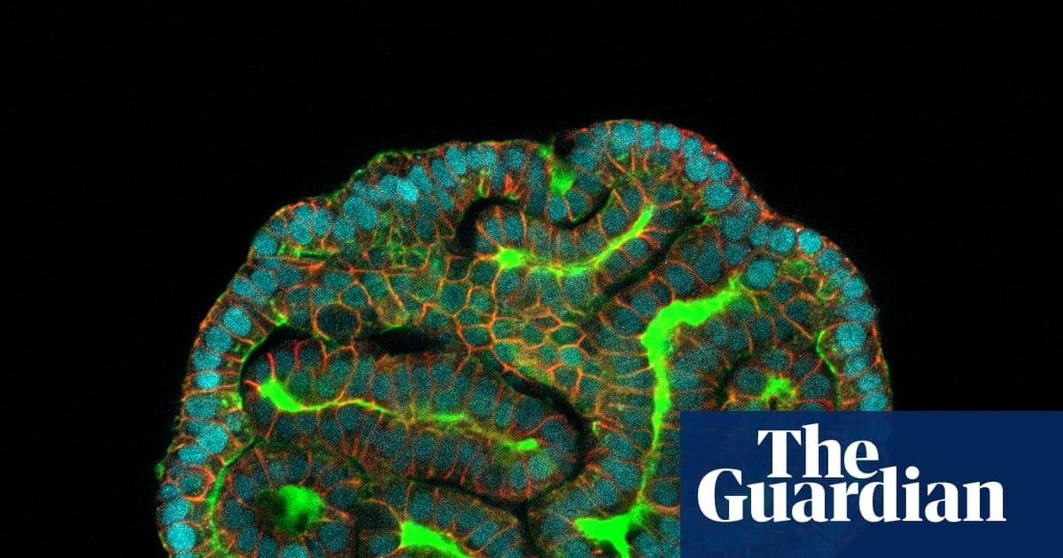 ‘A mouse can’t tell us what wo...