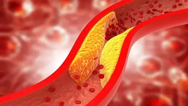 5  أطعمة على مائدتك قد تساعد على خفض الكوليسترول الضار وحماية القلب