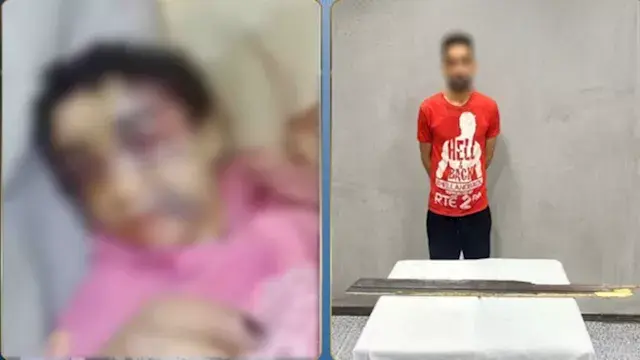 ضبط أب اعتدى على ابنته بعصا خشبية وأصابها بكسور في الإسكندرية
