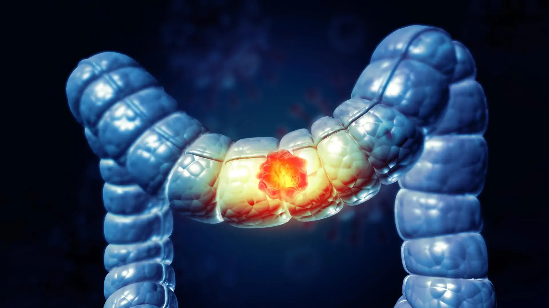 A simple at-home test could cu...