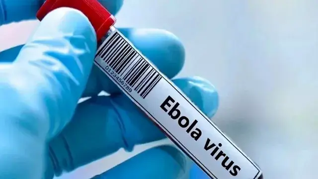لقاح مصري في مواجهة إيبولا.. ت...