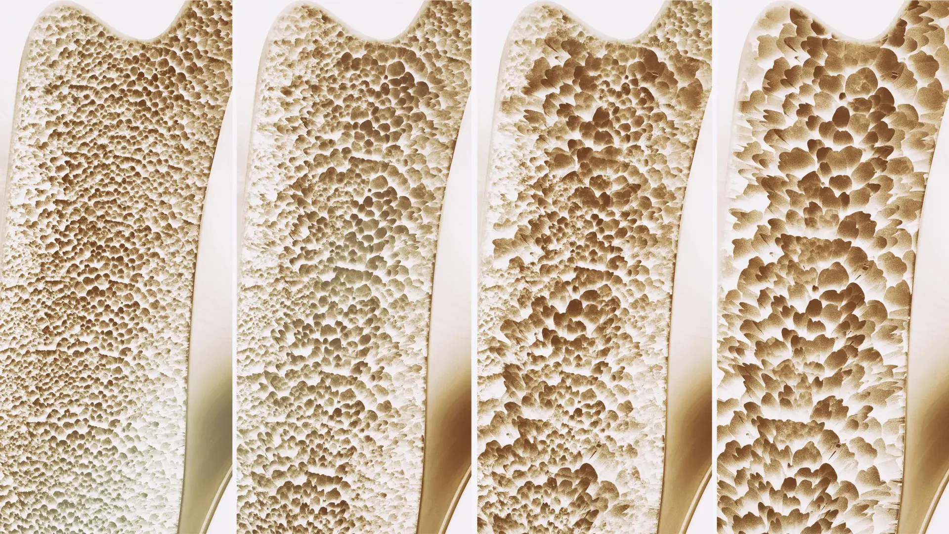 Scientists find a bone-buildin...