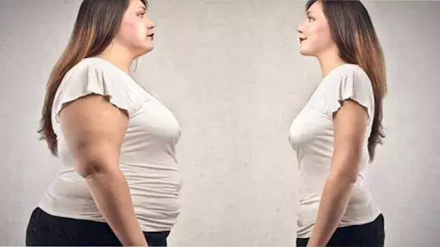 بعد وفاة صيدلانية أثناء العملية.. مخاطر جراحة شفط الدهون